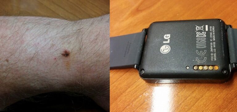 LG G Watch contatos corroídos e machucados