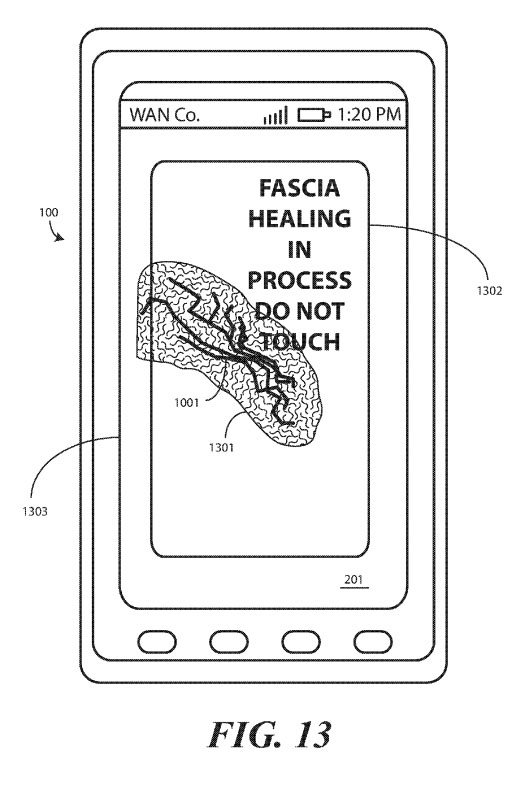 Patente Motorola tela que se auto regenera