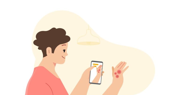 Google ferramenta dermatológica